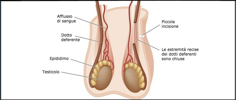 CTFR 3