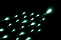 Azoospermia